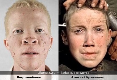Негр-альбинос напомнил Алексея Кравченко