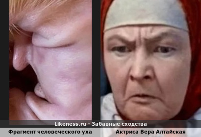 Фрагмент человеческого уха немного напоминает актрису Веру Алтайскую