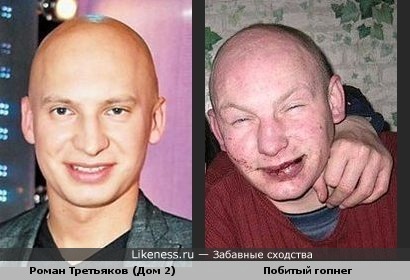 Роман Третьяков похож на побитого гопника