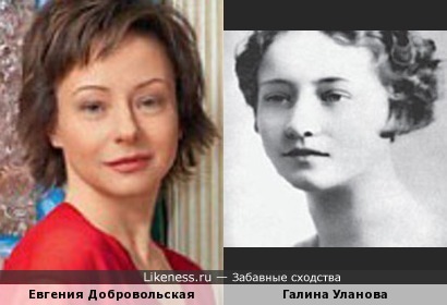 Лицо добровольской после пластики Лицо добровольской после пластики