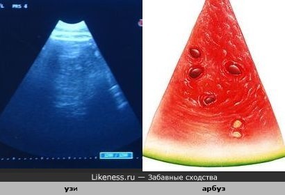 Ломтик арбуза похож на экран аппарата ультразвукового исследования
