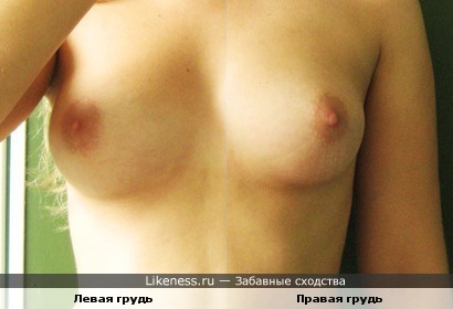 Левая женская грудь похожа на правую грудь