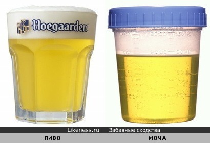 если цвет мочи как пиво если цвет мочи как пиво