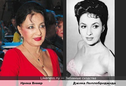 Ирина винер до и после пластики фото