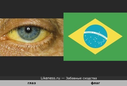 Флаг Бразилии похож на воспалённый глаз