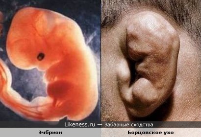 Эмбрион и борцовское ухо)