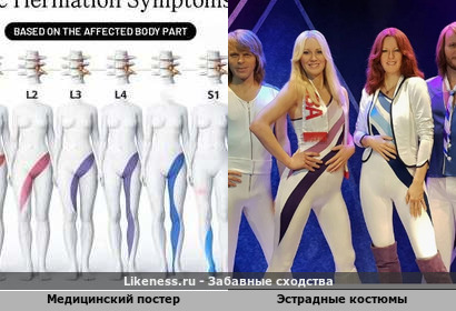 Медицинский постер напомнил эстрадные костюмы группы ABBA