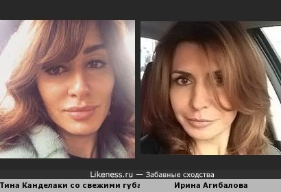 Тина Канделаки со свежими губами похожа на Ирину Агибалову