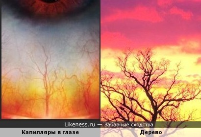 Макросъёмка капилляров в глазах напоминает изображение дерева