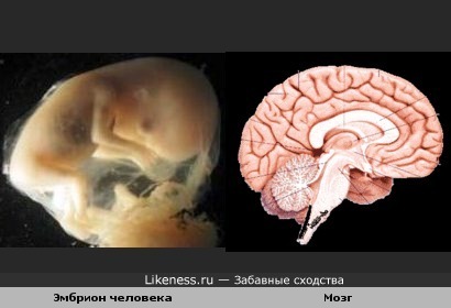 Эмбрион человека похож на мозг