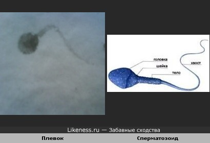 Плевок слюны на снегу похож на сперматозоид