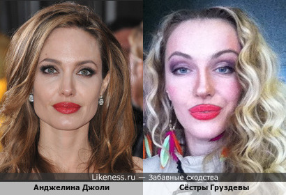 Сёстры Груздевы реально похожи на Анджелину Джоли