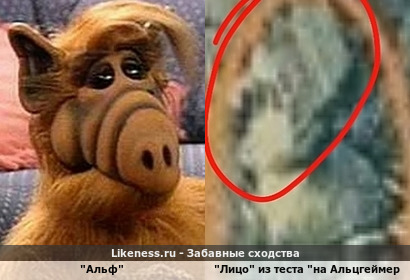 "Лицо" из теста "на Альцгеймера" (*скорее, на парейдолию XD) напомнило Альфа (для дополнительных лулзов см. комментарий)