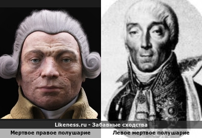 Мертвое правое полушарие напоминает левое мертвое полушарие