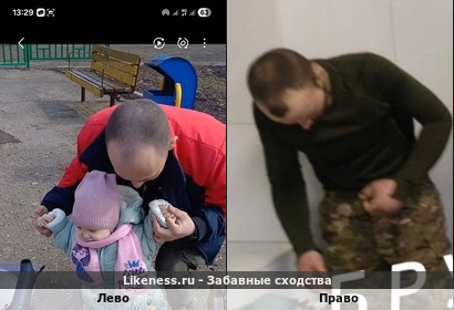 Лево напоминает правое рост волос и нос