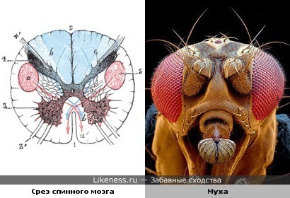 Поперечный срез спинного мозга напоминает голову мухи