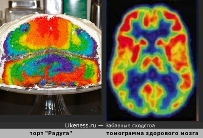 Психоделический тортик напомнил позитронно-эмиссионную томограмму головного мозга